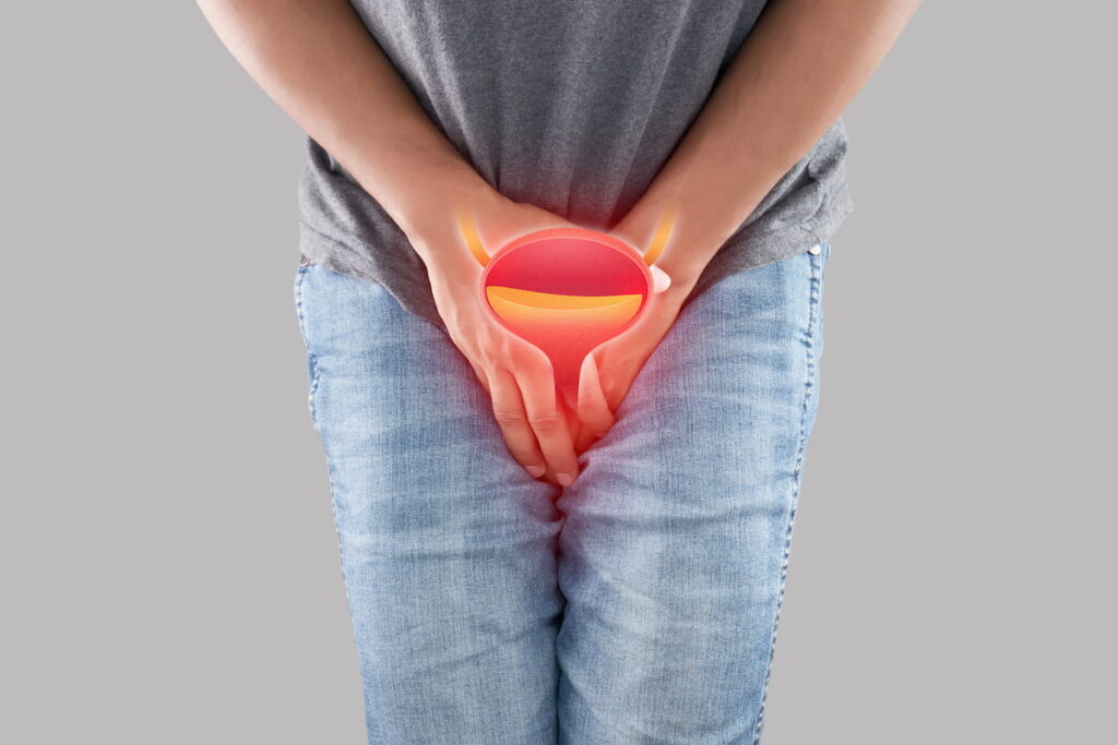 Cistite Maschile: Comprendere e Trattare l’Infiammazione della Vescica nell’Uomo