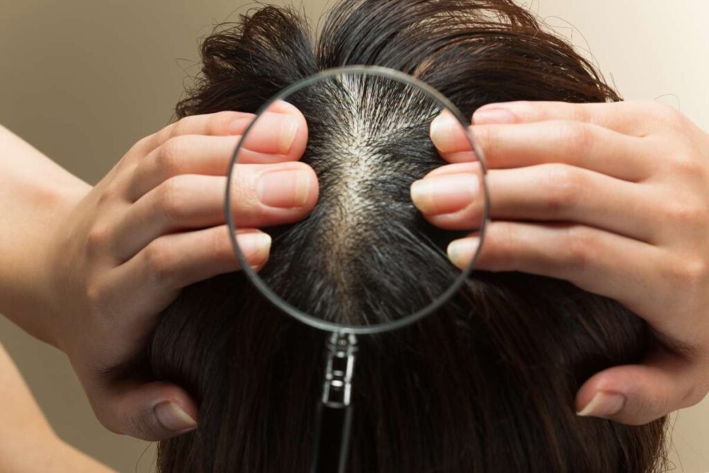 Capelli Grassi: cause più comuni e strategie efficaci per eliminarli