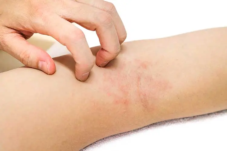 Allergia ai Detersivi? La Soluzione sono i Guanti in Cotone!