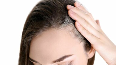 Capelli Bianchi: possiamo davvero prevenirli o farli regredire ?