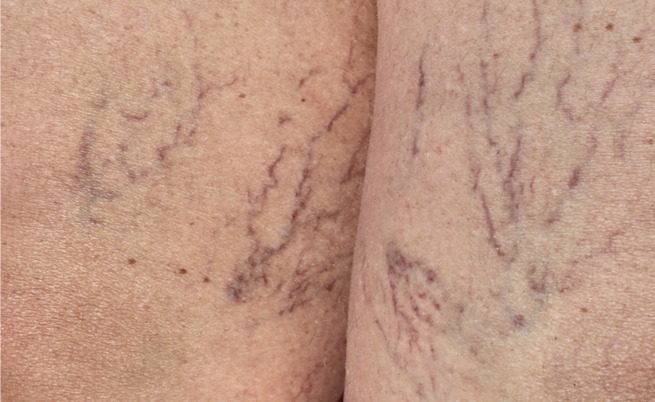 Un viaggio attraverso i capillari: la mappa nascosta del nostro corpo