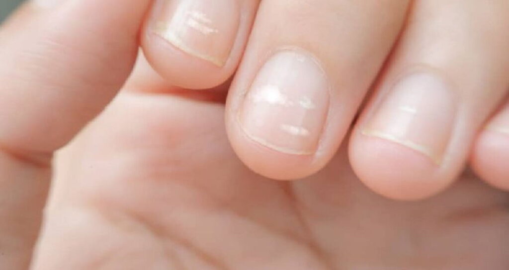 Unghie: come conoscere il nostro corpo osservandole